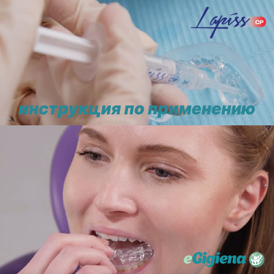 Инструкция по применению набора для отбеливания Lapiss CP 16%